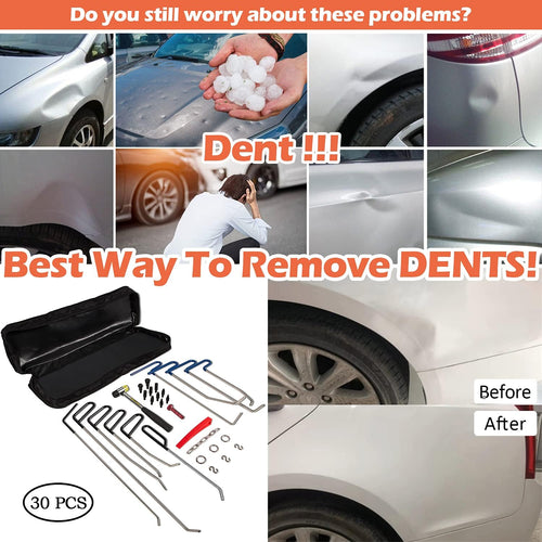 30 Pcs Paintless Dent Repair Tools Kit A289273